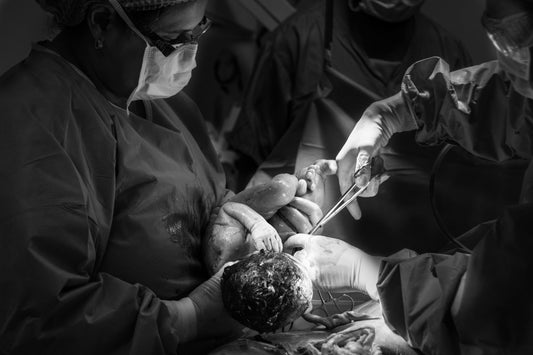 Doctors performing a C-Section
