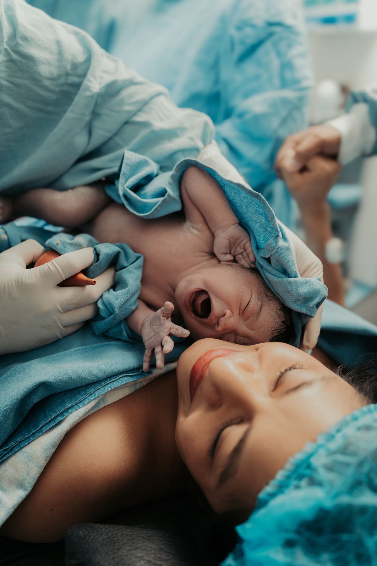 Mother on the operating table during a C-section, her crying newborn placed against her cheek